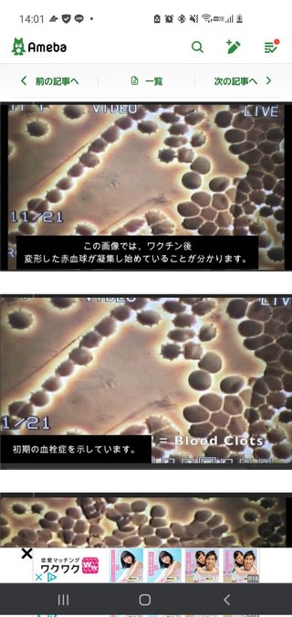看護師さん 「ワクチン後に体調おかしい人最近ほんと多いのよ…」