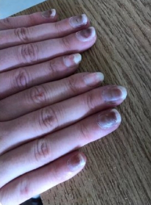 中国人たちによるビデオ会議、米軍兵士にワクチンを接種させてアメリカを崩壊させる