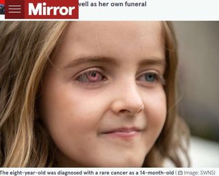 右眼球を摘出した8歳女児、キラキラ輝くピンク色の義眼で“スーパーヒーロー”に（英）