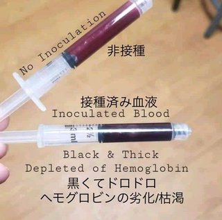ワクチン非接種と接種済みの血液の比較、接種者の血液は壊死して黒色、驚愕！