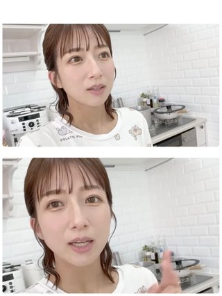 辻ちゃん整形した？