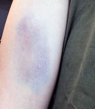 DeNA中継ぎエース田中健二朗　妻へのDV写真と3人不倫