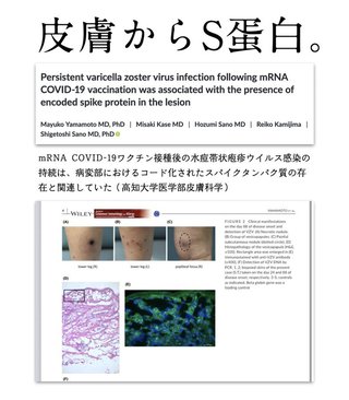 （高知大学）皮膚の病変から毒ワクチンのS蛋白質を検出。致命的な血栓毒物だよ