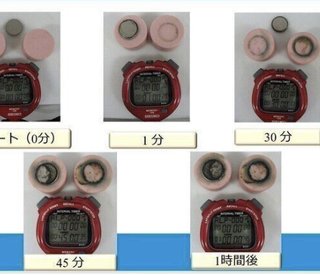 ボタン電池等の誤飲は命が危ない！　短時間で子どもの消化管がただれる可能性が【小児科医】 