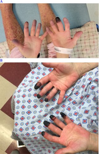 大阪の子供の間で 「ワクチンを打つと死ぬ」 と言う噂を児童が皆知ってるww