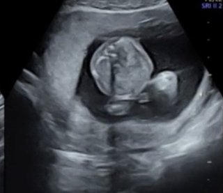 性別予想をきかせてください