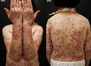 李氏( レビ氏ユダヤ人)、華僑たちが毒ワクチンをあおって日本人大虐殺企画