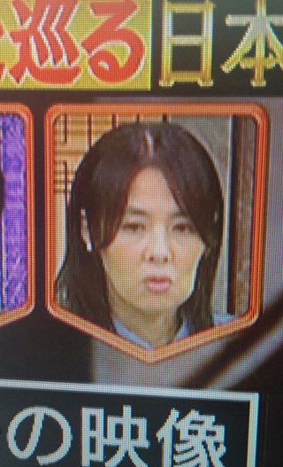 ん？井森美幸さん顔どうしたの？