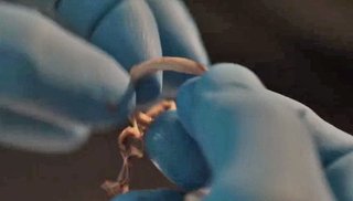 ワクチン接種者の体内のあちこちで大事に育てているホワイトクロット。寄生虫