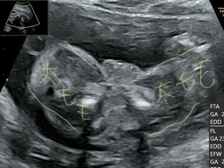 性別がわかりません。。
