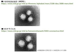 全世界に毒ワクチン接種させるための 中国やつらの詐欺コロナ死亡撮影ww 