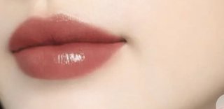 来月額のヒアルロン酸と鼻に糸入れて唇もヒアルロン酸入れてくるよ