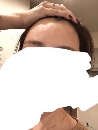 今日整形してきたよ