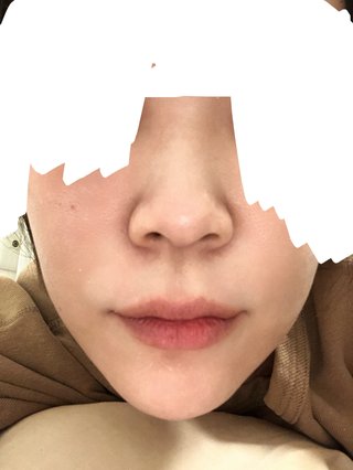 あした整形してくるよ