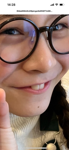 双子のりんかあんなちゃん