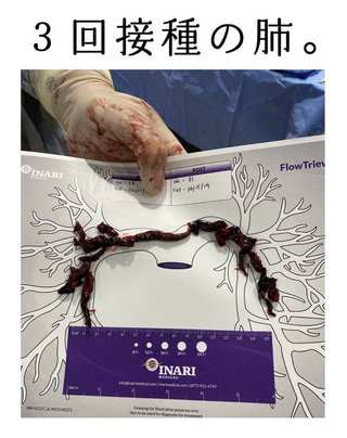 ワクチン打って自衛隊員700人が死亡