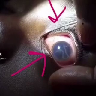 中国軍の生物化学兵器、毒ワクチン打って日本人64万人が死亡