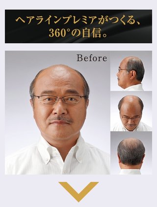 【兵庫】「はげ、はげ、はげは嫌い」と歌った小学6年生にラリアット 55歳無職男逮捕