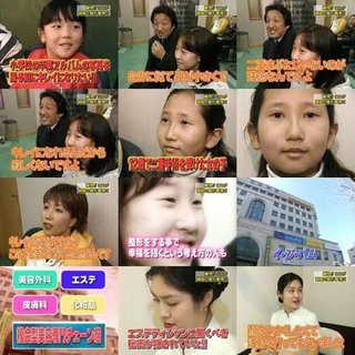 韓国人小学生「小学校の卒アルで綺麗に写りたいから整形する」