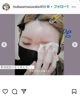 益若つばさ(37)「重度の帯状疱疹」でダウン　頭痛、水ぶくれで痛々しい姿　骨折からの復帰延期 