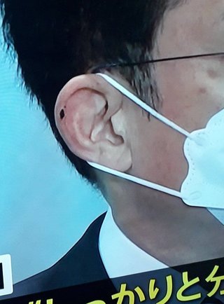 毒ワクチン爬虫類こいつの耳の黒い点は何だろう？ww 