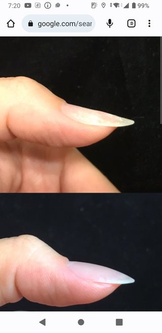 みなさんの爪はどっち？