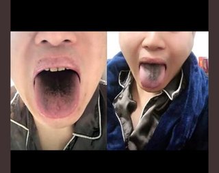 中国軍のコロナ詐欺、黒い舌www爆笑 