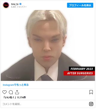 BTSの顔になろうと12回整形したカナダ人俳優、22歳で死去