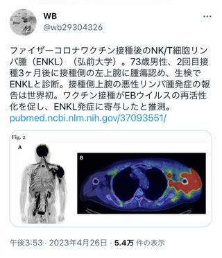 結果論だけどワクチン打たなくて良かった