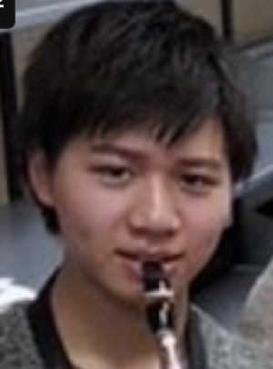 Matt「急に腫れてしまいました」ヒアルロン酸大量注入のあごに異変「遅発性結節」と診断