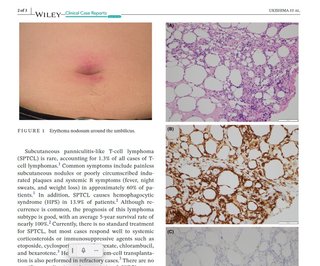 ママ友が“反ワクチン”を強烈に主張…距離を測りかねる39歳女性の｢苦悩｣