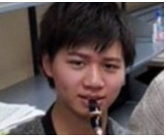 Matt「急に腫れてしまいました」ヒアルロン酸大量注入のあごに異変「遅発性結節」と診断