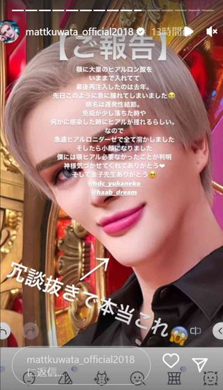 Matt「急に腫れてしまいました」ヒアルロン酸大量注入のあごに異変「遅発性結節」と診断