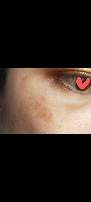 お勧めの基礎化粧品　~40代~