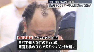 自宅で知人女性の4歳娘を手のひらで殴りケガさせたか…36歳の男逮捕　柏市