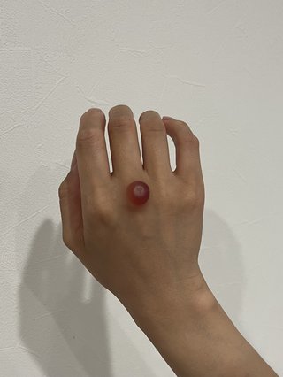 液体窒素でイボの治療した事ある人