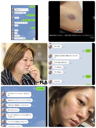 美奈子、義人からの脅迫LINEと暴力を受けたんだって！