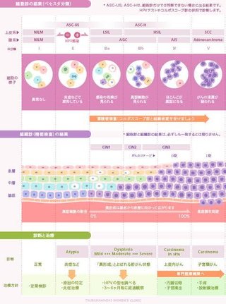 子宮がん検診の再検査