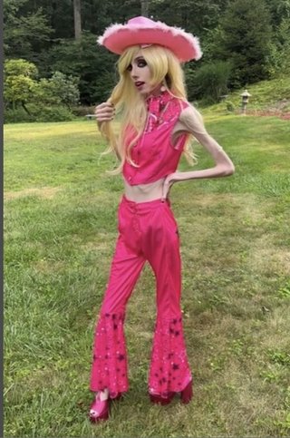 「悲しいほど痩せている」摂食障害を告白した女性YouTuberに心配の声「視聴者に悪影響を