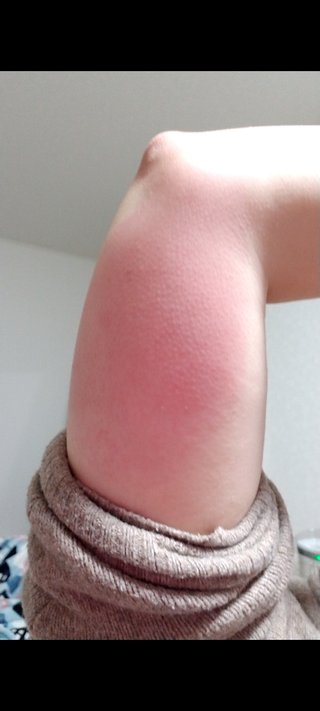 インフルエンザワクチン打つ？