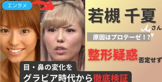 若槻千夏って、鼻整形してるよね？