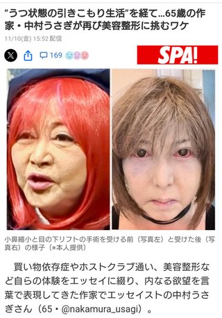 “うつ状態の引きこもり生活”を経て…65歳の作家・中村うさぎが再び美容整形に挑むワケ