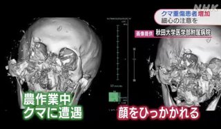 ｢クマ被害｣激増も駆除にクレーム殺到…｢クマ殺すな｣と訴える人は野生のクマと同じで話が通じない