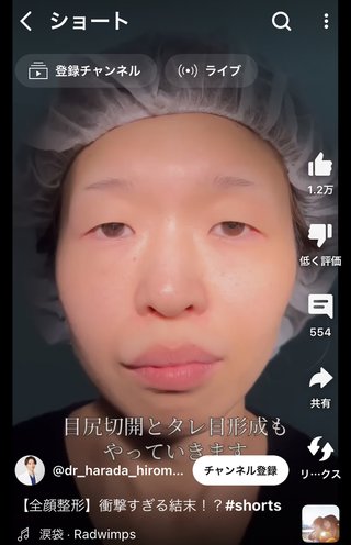 美容整形で大変身したこの人、衝撃！