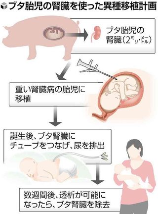 ブタの腎臓を胎児に移植、透析までの「橋渡し」に…国内初「異種移植」を慈恵医大など計画