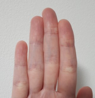 人差し指より　薬指が長い人は自閉症　男60代90%なのに男20代は68%　東京大学が発表
