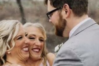 シャム双生児の女性が結婚、相手は男性一人