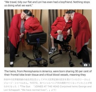 「分離を望んだことはない」世界最高齢の結合双生児、62歳で亡くなる（米）