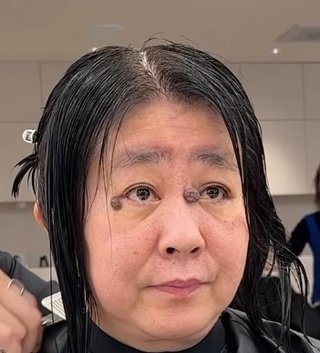 イボみたいなホクロ顔にある人