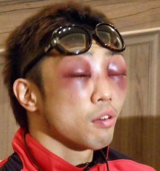 井上尚也ってボクシングの人をニュースで見たけどイケメンじゃない？